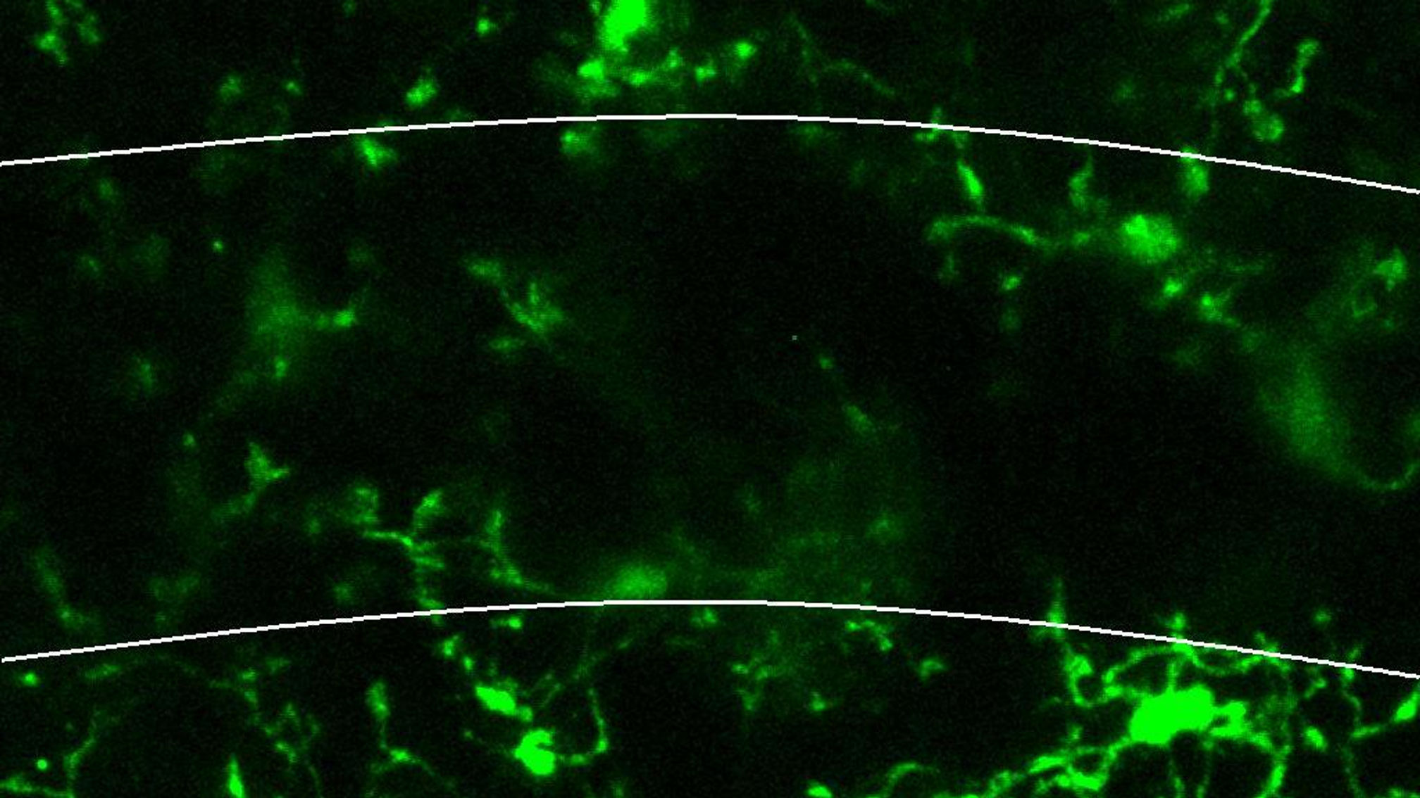Microglia Respond by Extending Their Processes Towards Neurons in Hippocampal Brain Slice with Glutamate Treatment